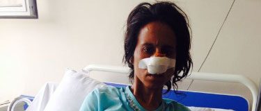 Eşinin burnunu kesen koca aranıyor