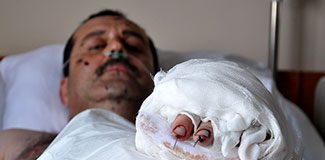 Ramazan topu elinde patladı