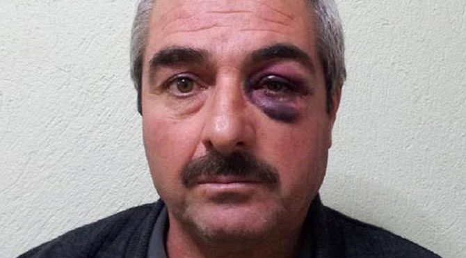 Öğretmene veli dayağı!