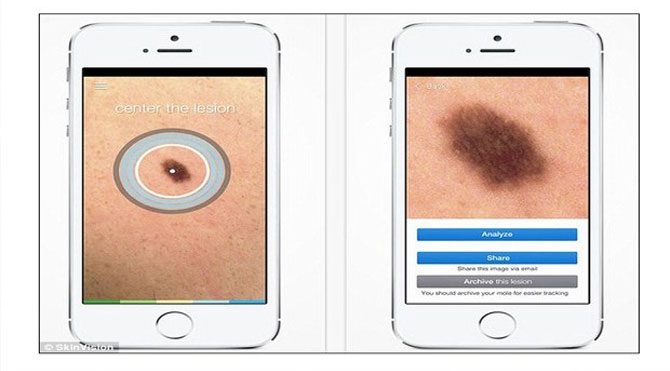 Akıllı telefon kanser teşhisi koyuyor!