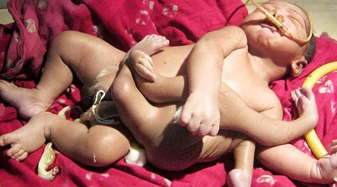 4 kollu 4 bacaklı bebek