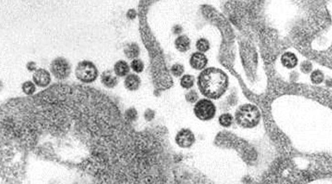 Afrika’da Ebola’dan sonra Lassa virüsü paniği