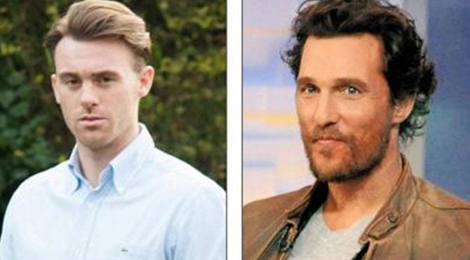 Komaya girdi, Hollywood yıldızı oldu