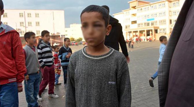 11 yaşındaki öğrenciye okulda dayak