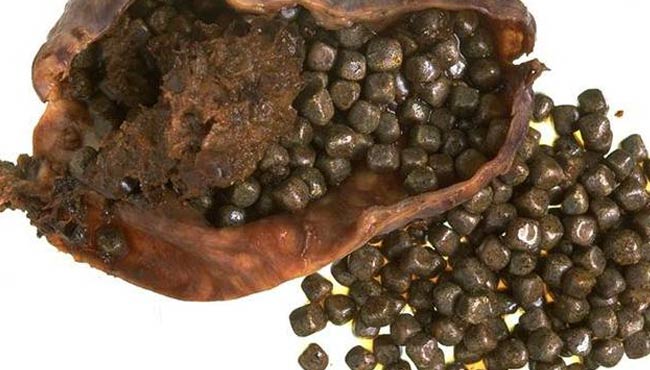 safra-kesesi-tasi-650