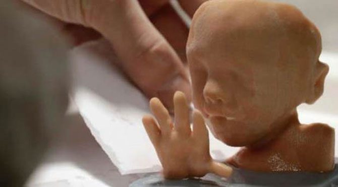 Ultrasonda son nokta