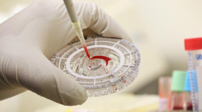 Ebola için 15 dakikalık test 