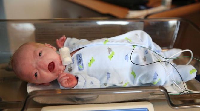 Burunsuz doğan bebek