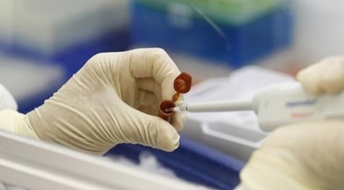 Åarbon sÃ¶zcÃ¼ ile ilgili gÃ¶rsel sonucu