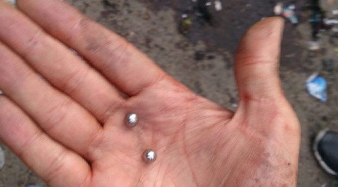 Bombalı saldırı mı?