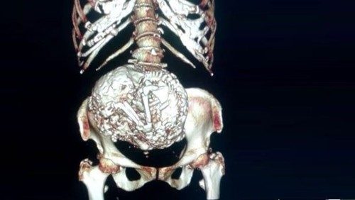 Estela Melendez-2 (Custom)