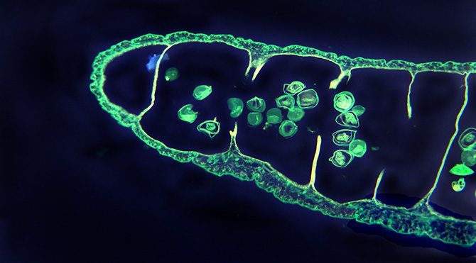ABD'li adamın beyninden canlı tenya alındı