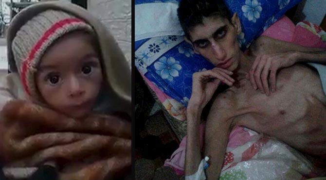 Madaya'ya yardım bugün yola çıkıyor