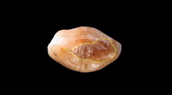 6500 yıllık diş dolgusu bulundu