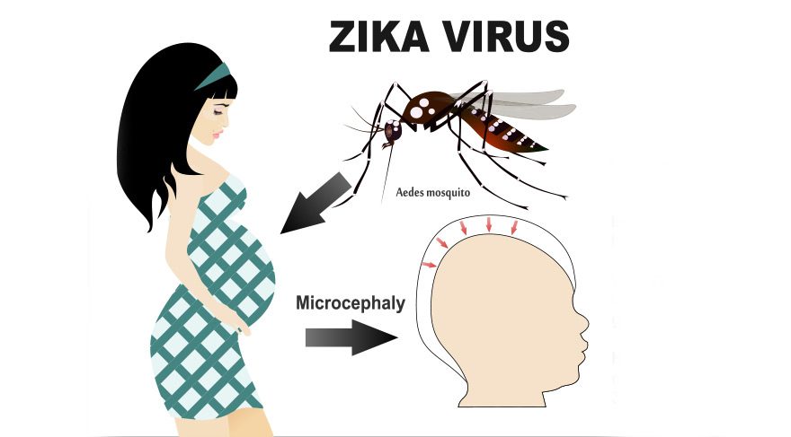 zika-virüsü