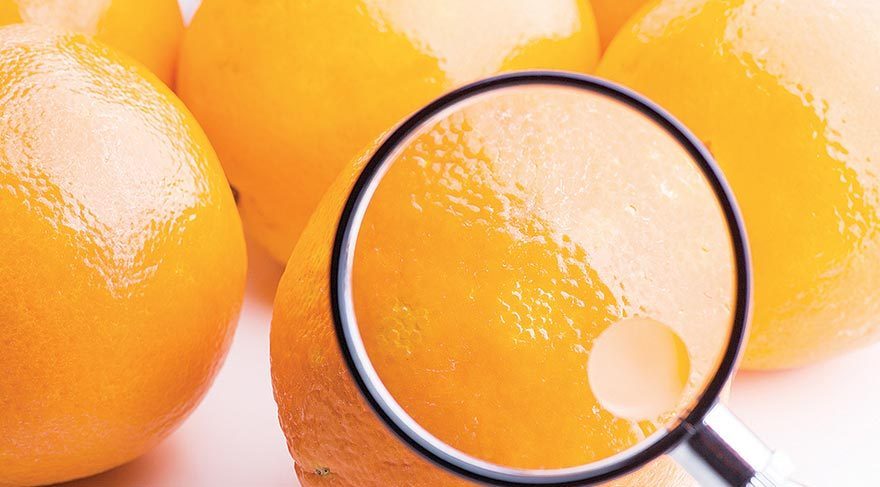 Selülit  oluşumunu etkilediği düşünülen teoriler şu şekilde özetlenebilir: 