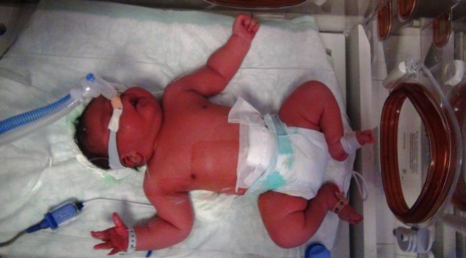 Suriyeli kadın, 5 kilo 750 gramlık bebek dünyaya getirdi