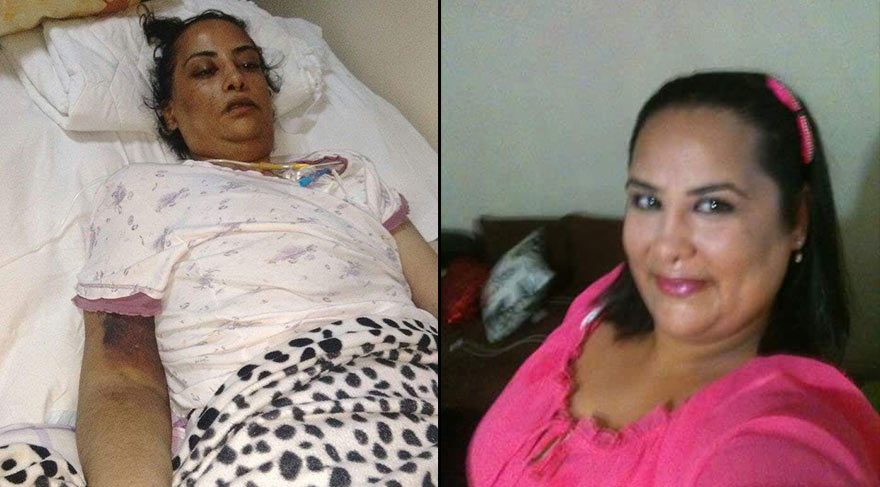 Mide küçültme ameliyatının ardından felç olan kadın öldü