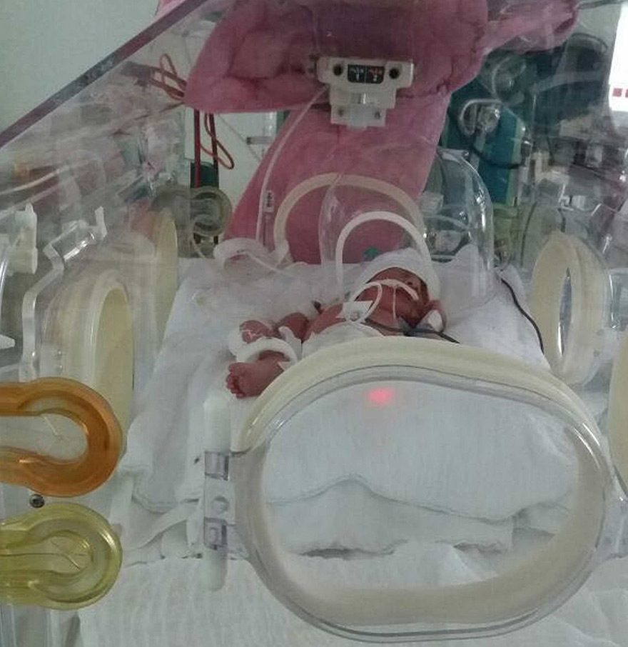 FOTO: iHA - Bursa’da kazada hayatını kaybeden 8 aylık hamile Tuğba Dilmeç’in karnından sezaryenle alınan Kaan bebeğe, bütün mikrobiyolojik tahlilleri yapılmış tek bir anneden alınan sütlerin verildiği belirtildi.