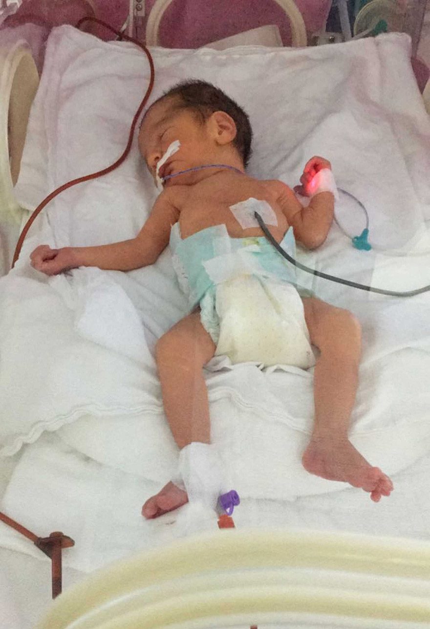 FOTO: iHA - Bursa’da kazada hayatını kaybeden 8 aylık hamile Tuğba Dilmeç’in karnından sezaryenle alınan Kaan bebeğe, bütün mikrobiyolojik tahlilleri yapılmış tek bir anneden alınan sütlerin verildiği belirtildi.