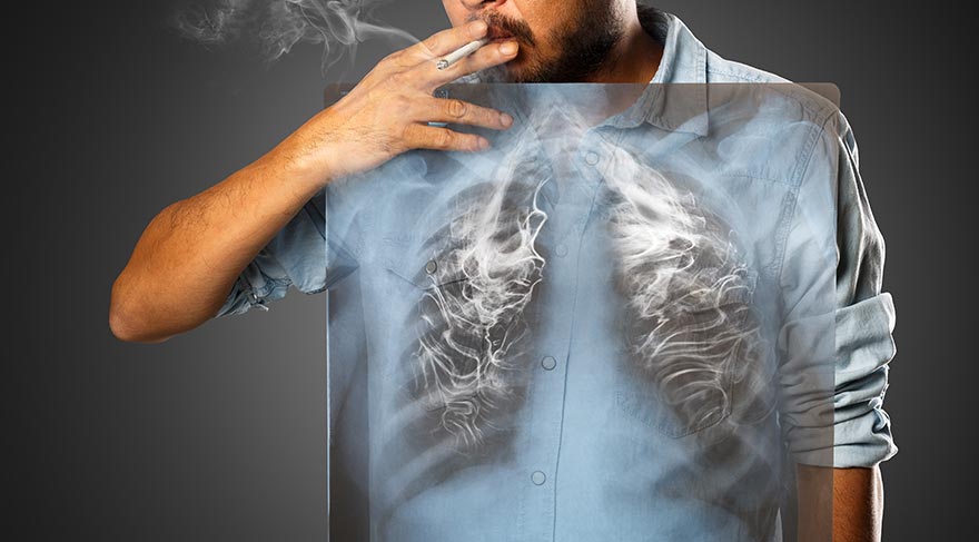 Akciğerini koru kanser olma!