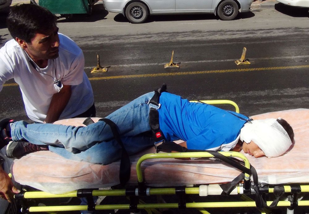 kardesinin-kulagina-sis-sapladi-2