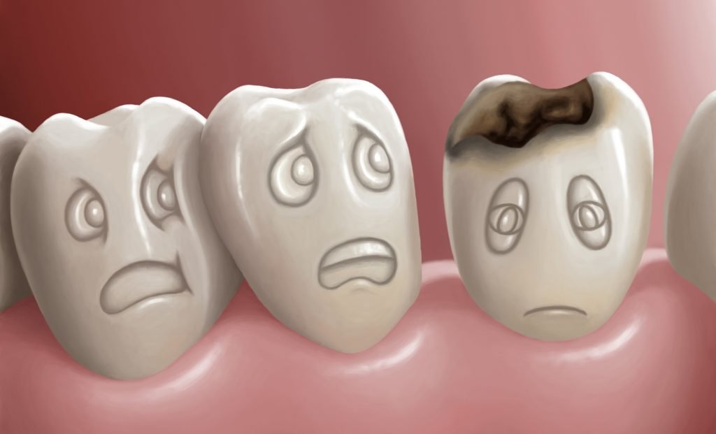 Bir dişin ölmesi ne demektir?