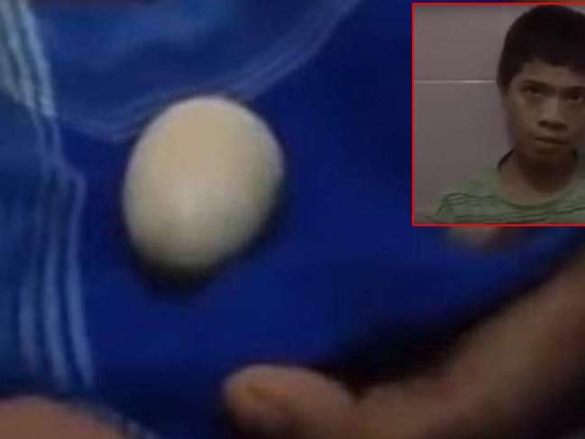 Doktorlar şaştı kaldı: 14 yaşındaki çocuk gözlerinin önünde "yumurtladı"