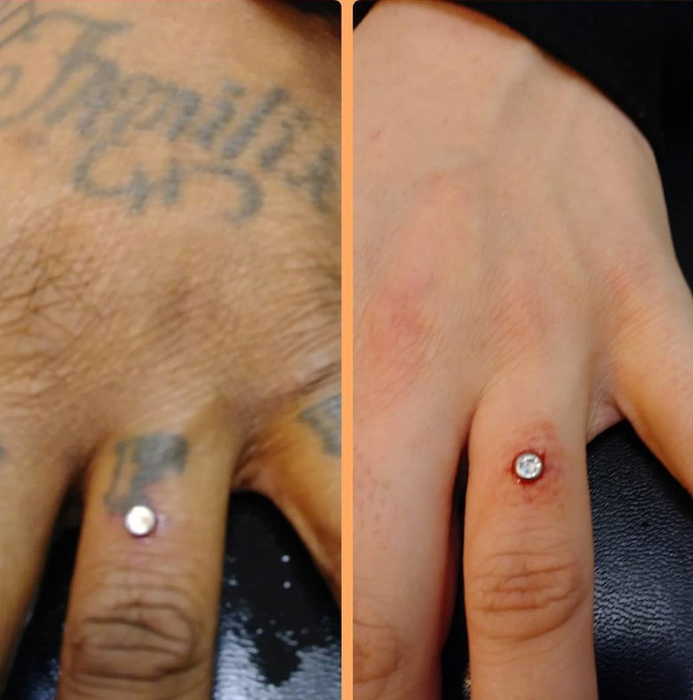dermal-piercing-instagram6