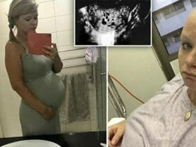 Hamile olduğunu sanıyordu! Doktorlar rahmindeki görünce şoke oldu