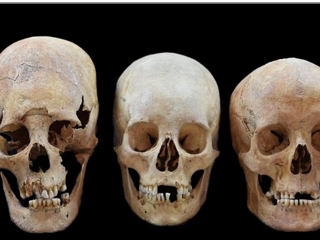 DNA analizi, Avrupa'nın ortasında, uzun kafatasına sahip Hun Türkü gelinlerini ortaya çıkardı!