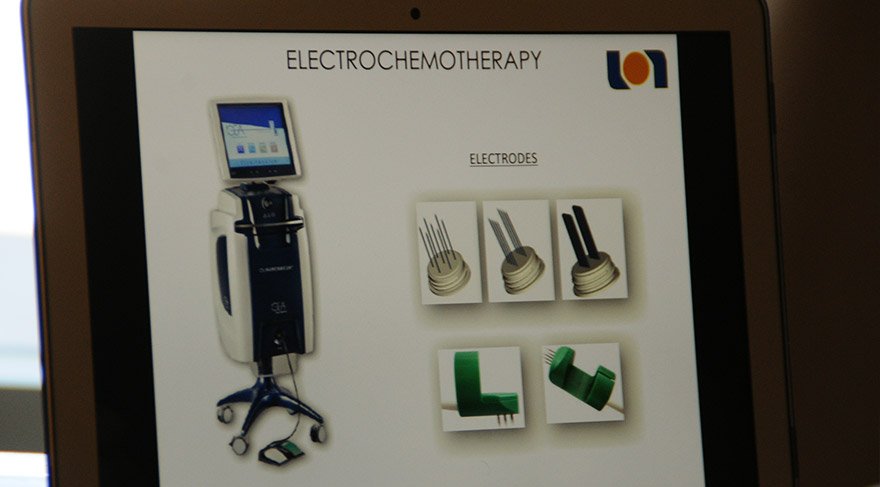 Elektrokemoterapi, Türkiye'de sadece İzmir'de uygulanıyor