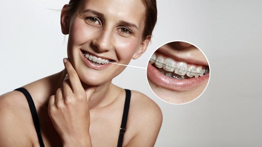 Ortodonti nedir? Ortodonti ile tedavi edilen problemler, ortodontik tedavi nasÄ±l olur?