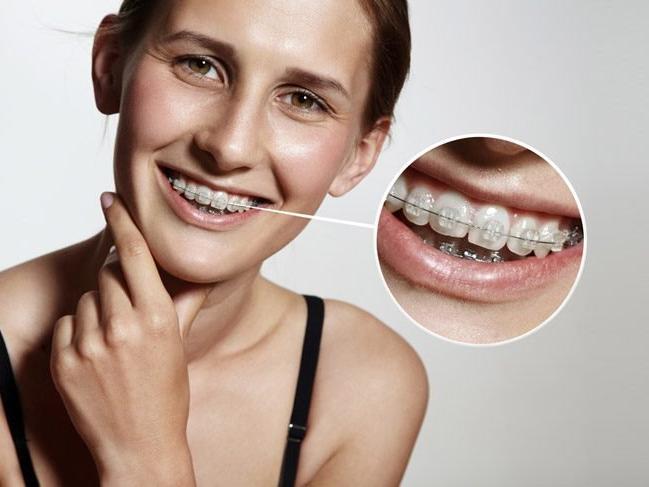 Ortodonti nedir? Ortodonti ile tedavi edilen problemler, ortodontik tedavi nasıl olur?