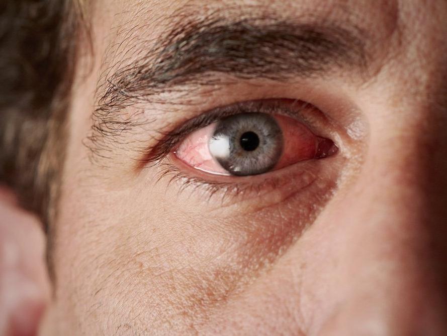 Gözdeki hangi sorun hangi hastalıkların sinyali?