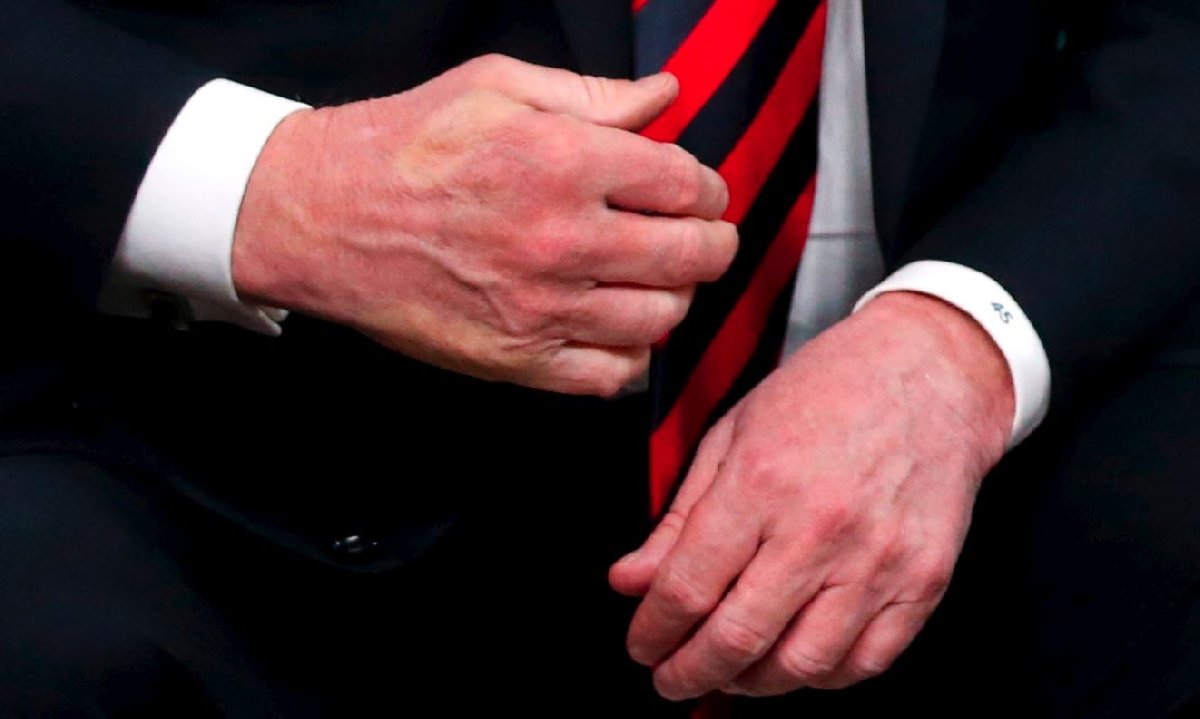 Trump'ın sağ elinde Macron'un parmak izi kaldı.