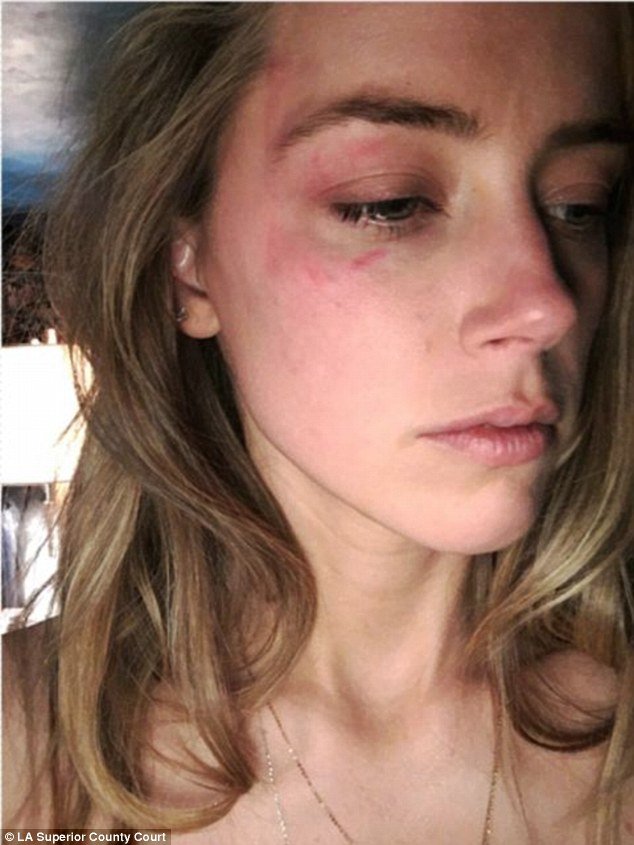 Amber Heard, Depp'in kendisine saldırdığını iddia etmişti.