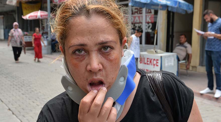 ADANA'DA 3 ÇOCUK ANNESİ SAİDE GÜNGÖR (33), ÇAMAŞIR SİLKELEYEN ÜST KOMŞUSUNU UYARDIĞI İÇİN, PARKE TAŞIYLA DÖVÜLEREK ÇENESİ KIRILDI. FOTO:DHA