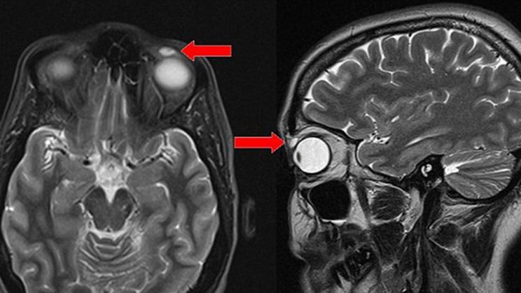 Doktorları şoke eden görüntü... 28 yıl boyunca böyle yaşamış!