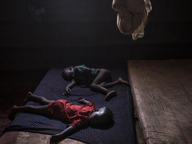Kolera salgınına 1 ayda 32 kurban