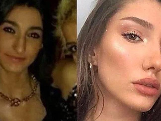Miss Turkey 2018 yarışmasına estetikli halleriyle başvurdular ve elendiler