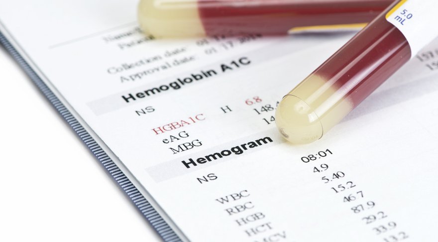 hemogram-nedir