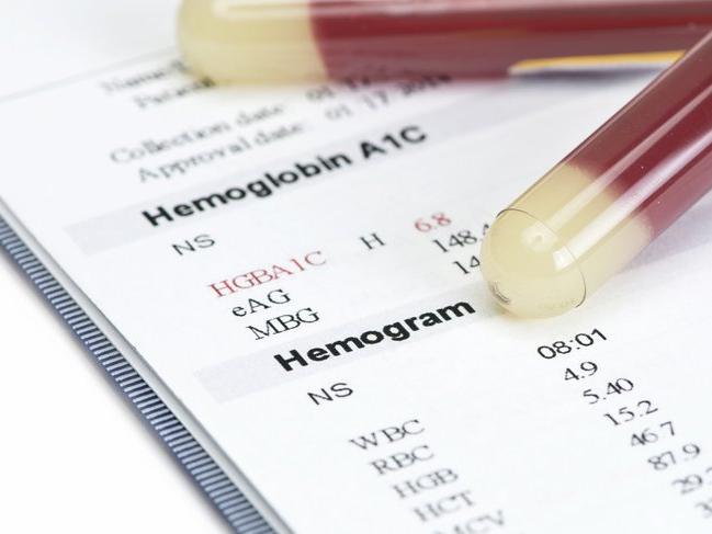 Hemogram testi (Tam Kan Sayımı) nedir? Hemogram testi nasıl yapılır? Hemogram değerleri nelerdir?