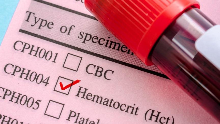 HCT: Hematokrit nedir? HCT yÃ¼ksekliÄi ve dÃ¼ÅÃ¼klÃ¼ÄÃ¼ ne anlama gelir?