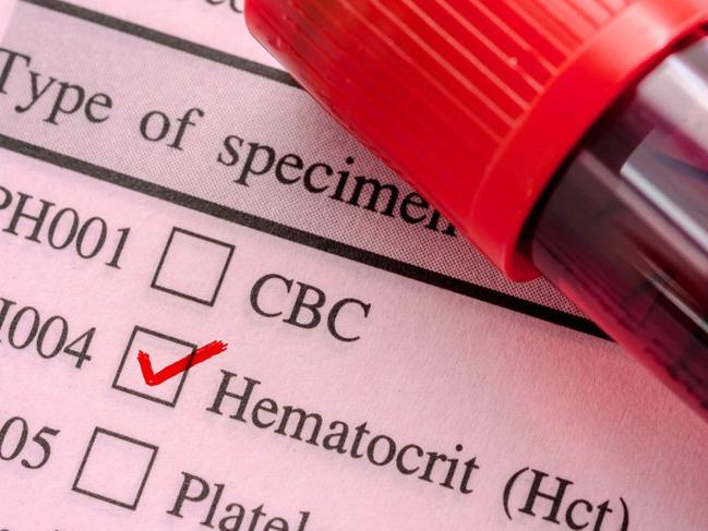 HCT: Hematokrit nedir? HCT yüksekliği ve düşüklüğü ne anlama gelir?