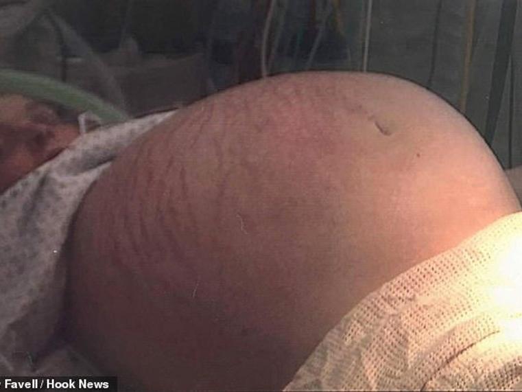 Hamile olduğunu sandı, hastaneye gidince neye uğradığını şaşırdı