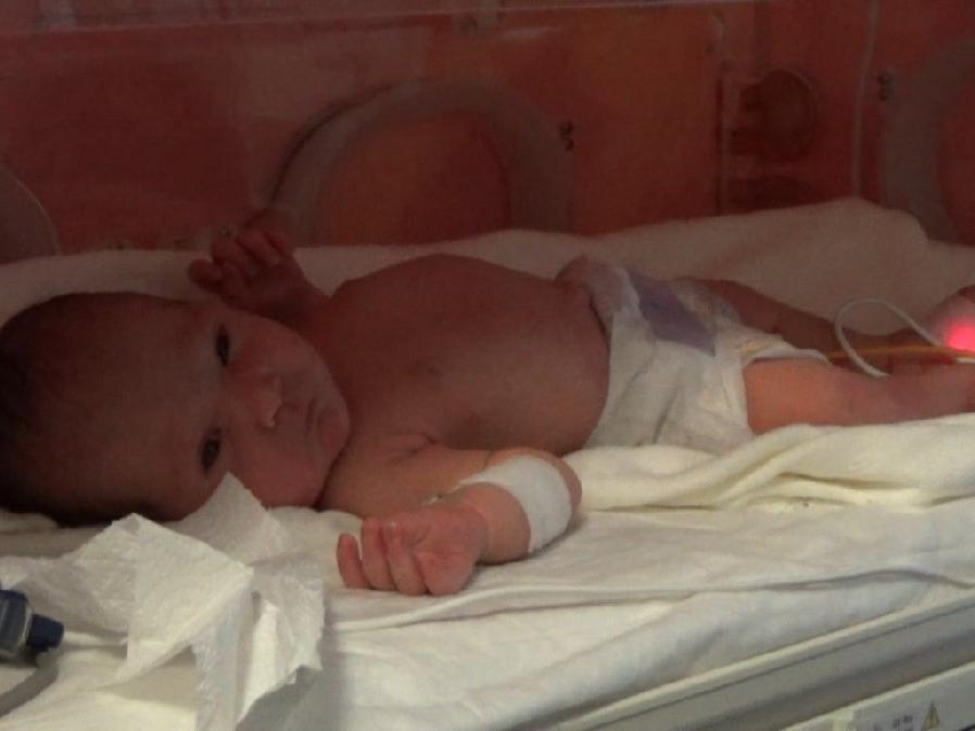 Yeni doğan bebeğe “doğumsal orta hat kapanma defekti” ameliyatı yapıldı