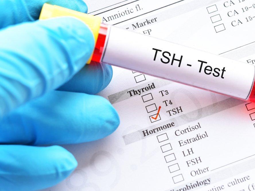 TSH: Tiroid uyarıcı hormon testi nedir? TSH yüksekliği ve düşüklüğü ne anlama gelir?