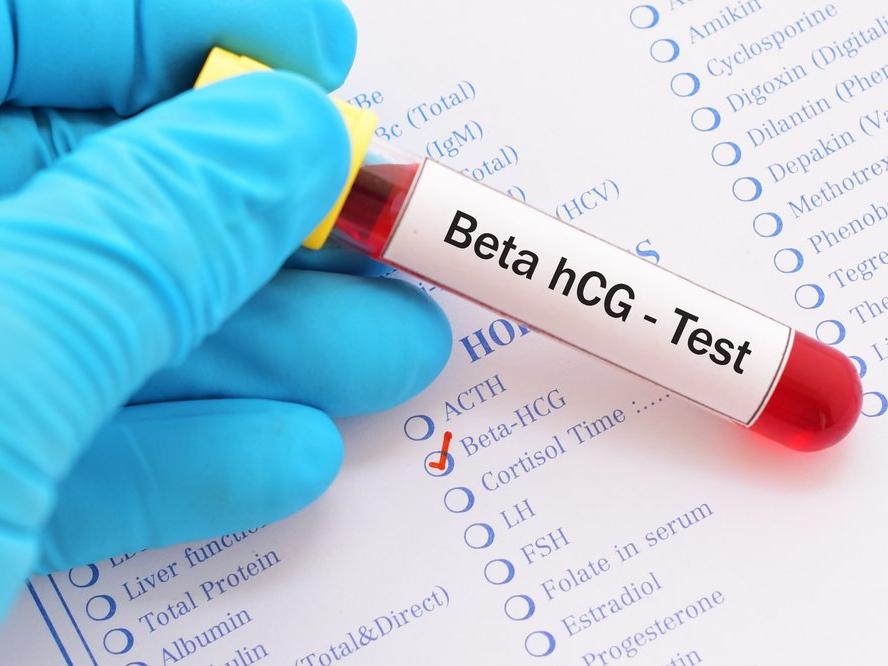 Beta HCG hormonu nedir? Beta HCG yüksekliği ve düşüklüğü ne anlama gelir?