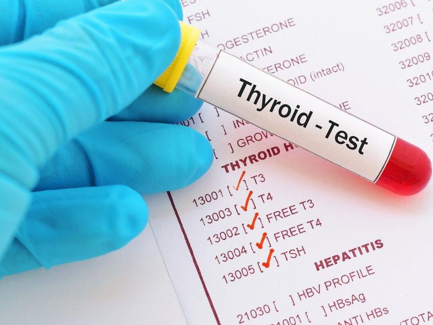 T3-T4 tiroid fonksiyon testleri nedir? T3-T4 değerlerinin yüksekliği ve düşüklüğü ne anlama gelir?